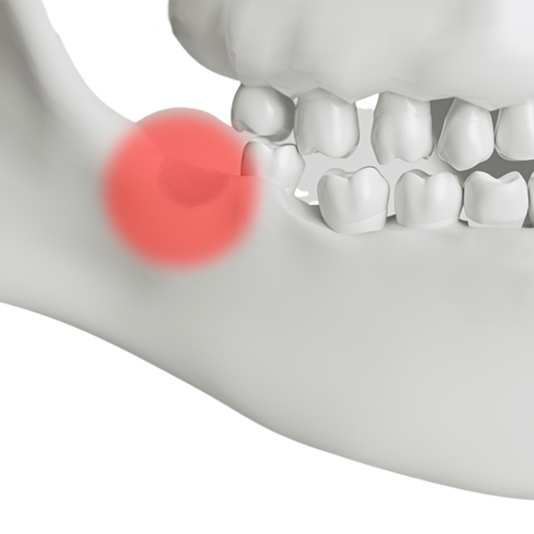 Oral Surgery In Nyc And East Hampton - Rejuvenation Health